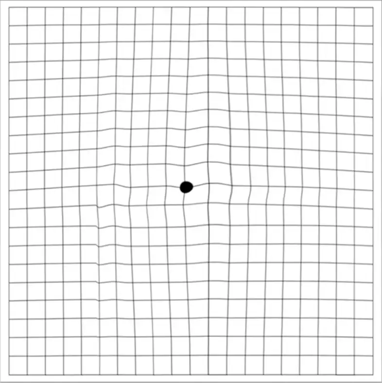 amsler grid right img